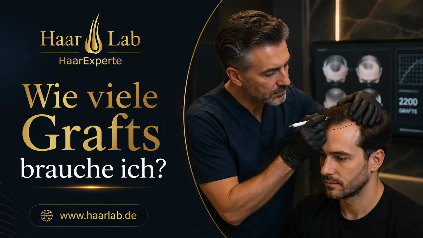 Worauf sollte man bei einer Haartransplantation in Frankfurt achten?